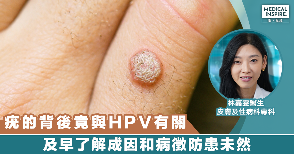 hpv是什么病尖锐湿疹图片