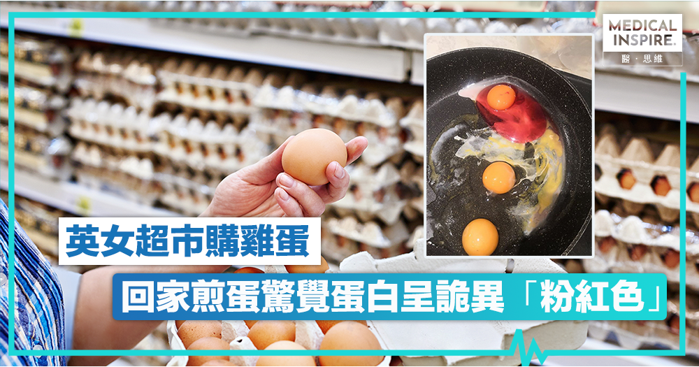 【食品安全】英女煎蛋發現「粉紅色蛋白」　網友大驚：這不能吃！