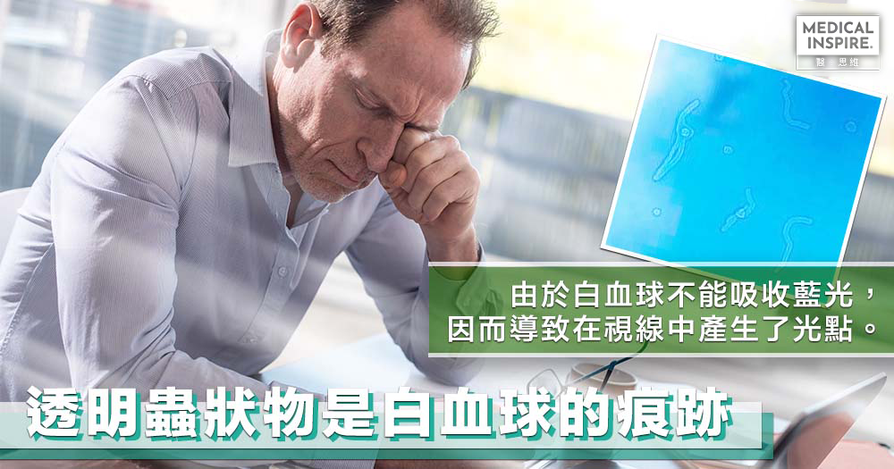 【破謬闢謠】看著藍天出現透明飄浮物，其實是你的白血球作怪。