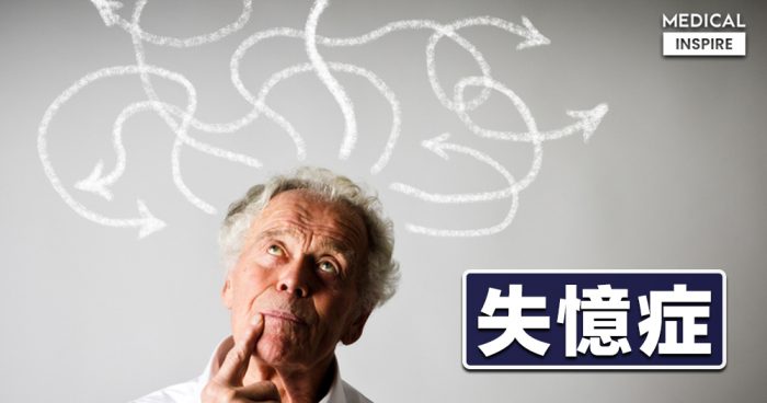 【專科資訊】失憶症的病因、徵狀及預防方法。 – Medical Inspire 醫・思維
