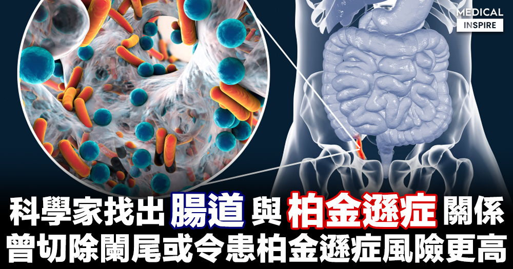 【醫學研究】闌尾接近大腸與小腸的接合處；研究指曾進行闌尾切除手術人士患柏金遜症風險更高。 – Medical Inspire 醫・思維