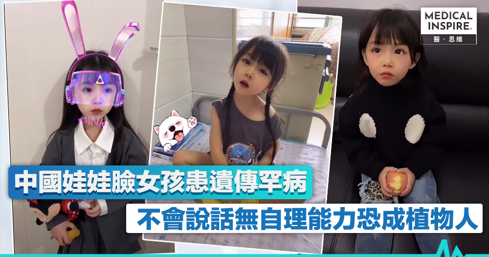 【罕見疾病】中國天使臉孔女孩擁200萬粉絲　揭患罕見病全球不足10例
