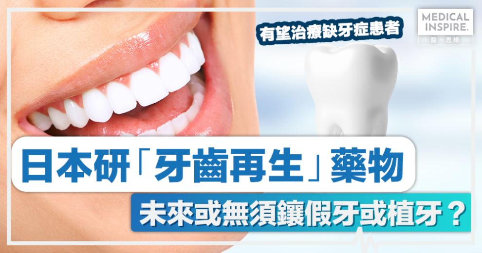 牙齒再生丨日本研「牙齒再生」藥物 未來或無須鑲假牙或植牙？