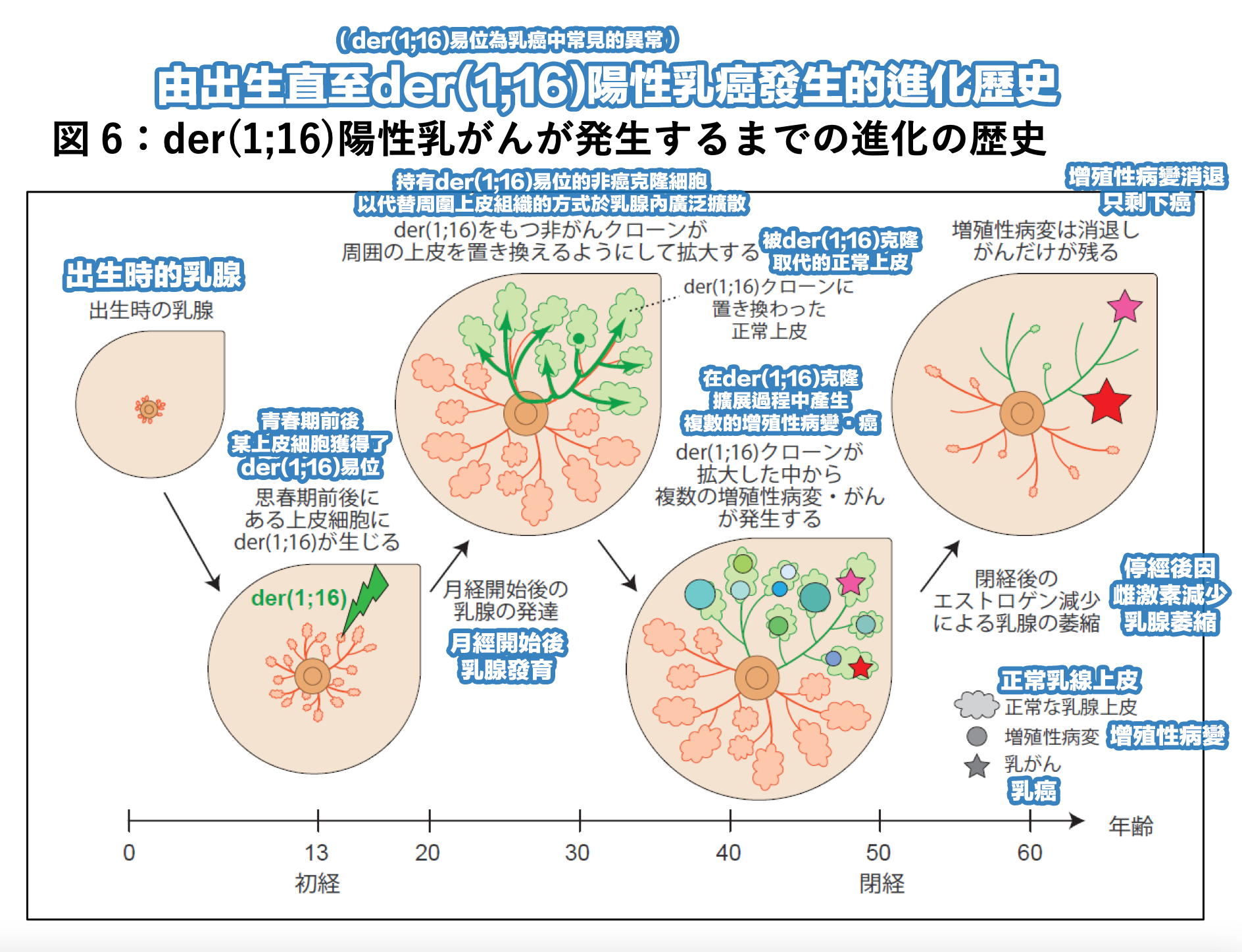 乳腺癌丨日本研究：乳癌預防及早期診斷現曙光！成功闡明乳癌發病機理過程及時間線。 – Medical Inspire 醫・思維