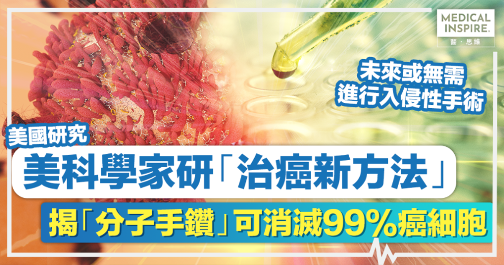 治癌新曙光丨美科學家研「治癌新方法」，揭「分子手鑽」可消滅99%癌細胞 – Medical Inspire 醫・思維