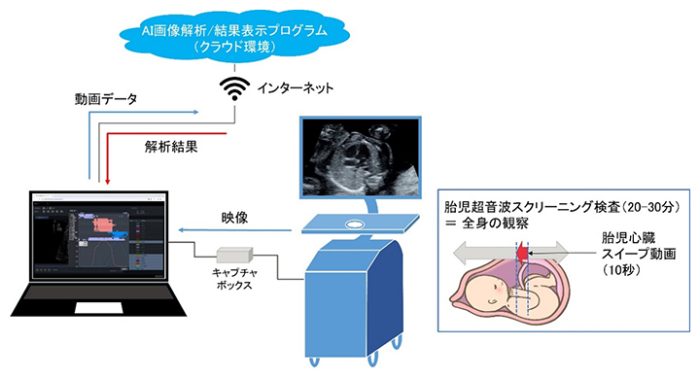 AI檢查胎兒心臟