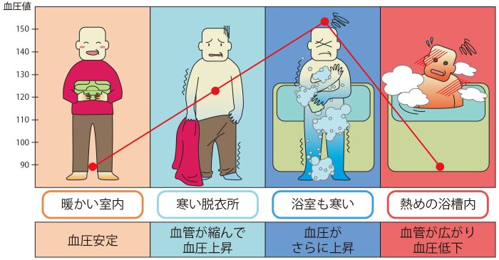 熱休克｜中山美穗疑浸浴致熱休克猝逝，緊記8重點預防！