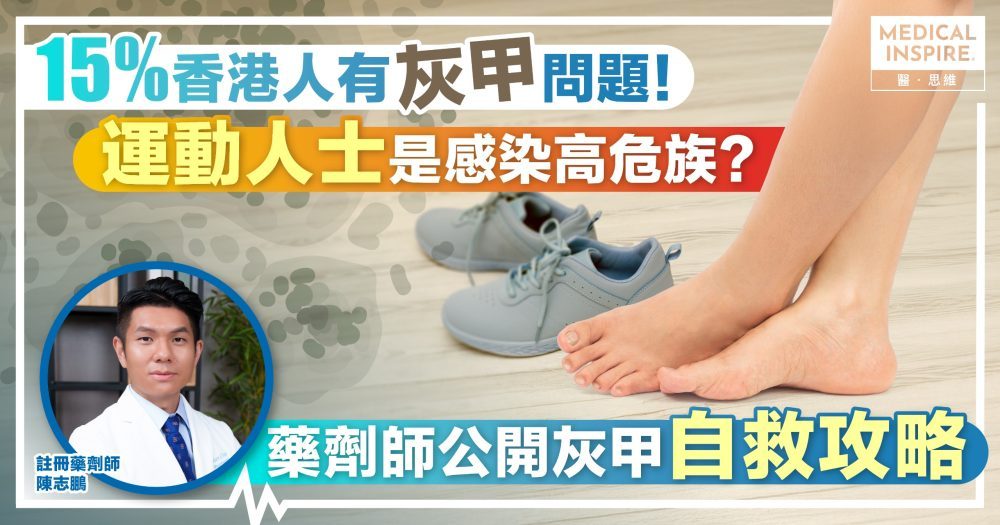 15%香港人有灰甲問題！運動人士是感染高危族？藥劑師公開灰甲自救攻略