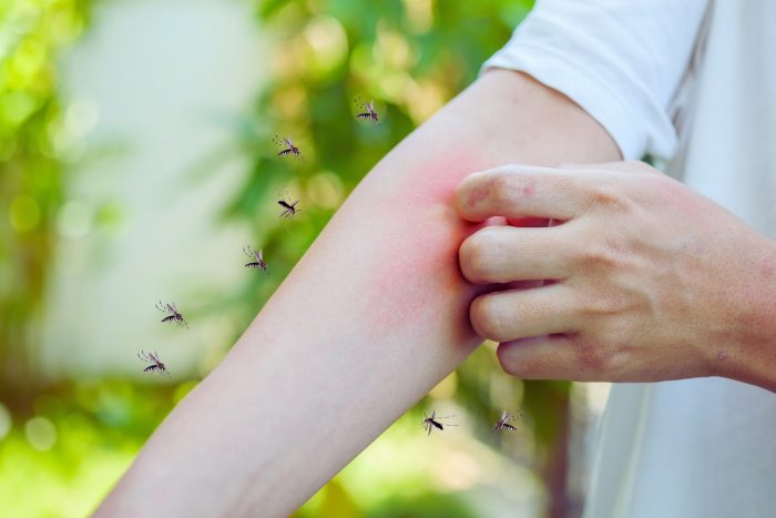 消委會驅蚊劑推薦｜基孔肯雅熱殺到，可致高燒、頭痛、長期關節炎！一文睇清9款滿分驅蚊劑，築起防蚊防病屏障