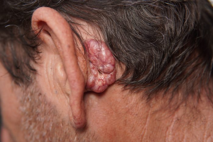 消委會面膜|逾9成泥狀面膜含重金屬,長期接觸或致疣狀增生及皮膚癌!即睇11款5星滿分名單,$79平貨媲美$590貴貨